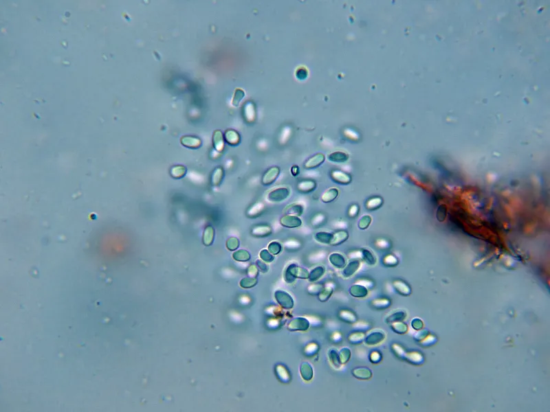 Boeremia hedericola Conidios 1